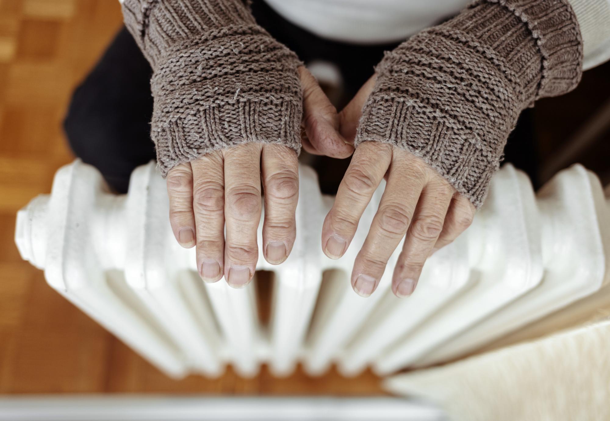 Woman warming hands up on a radiator